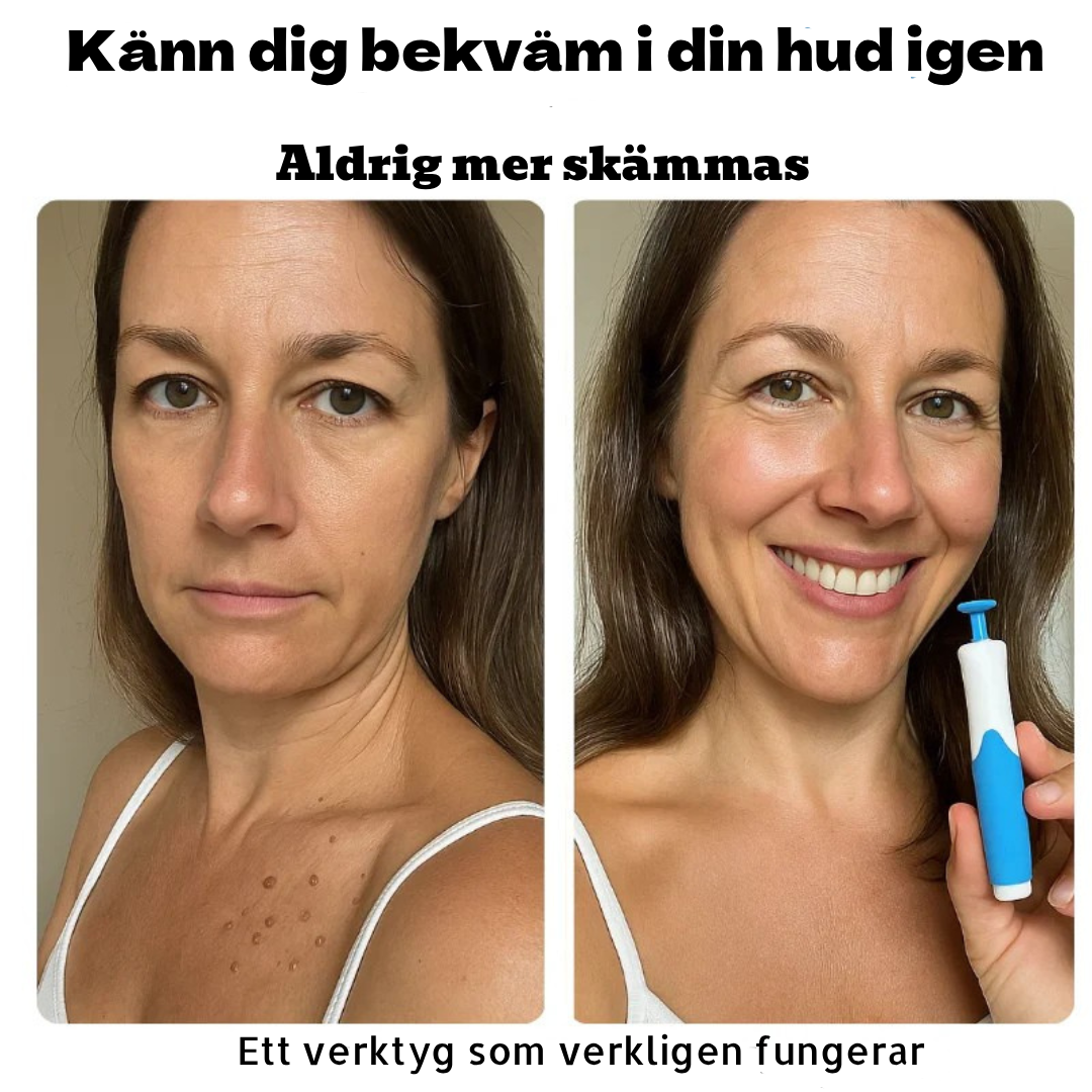 DermClear Set – Inga fler hudflikar
